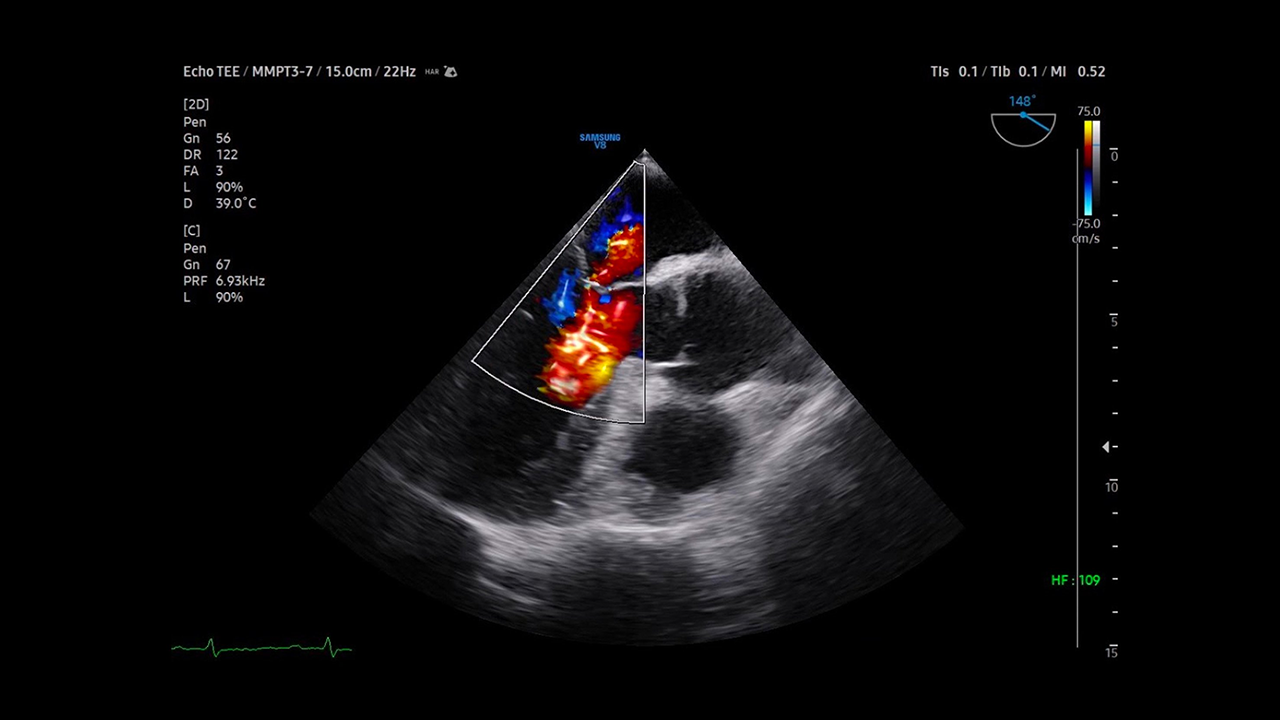 근골격계 정밀 초음파 센터